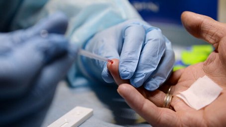 Найден первый в мире пациент, который мог победить ВИЧ без терапии