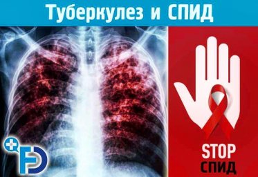 24 марта - Всемирный день борьбы с туберкулёзом