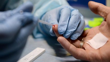 Названы пять самых неблагополучных регионов РФ по числу ВИЧ-инфицированных